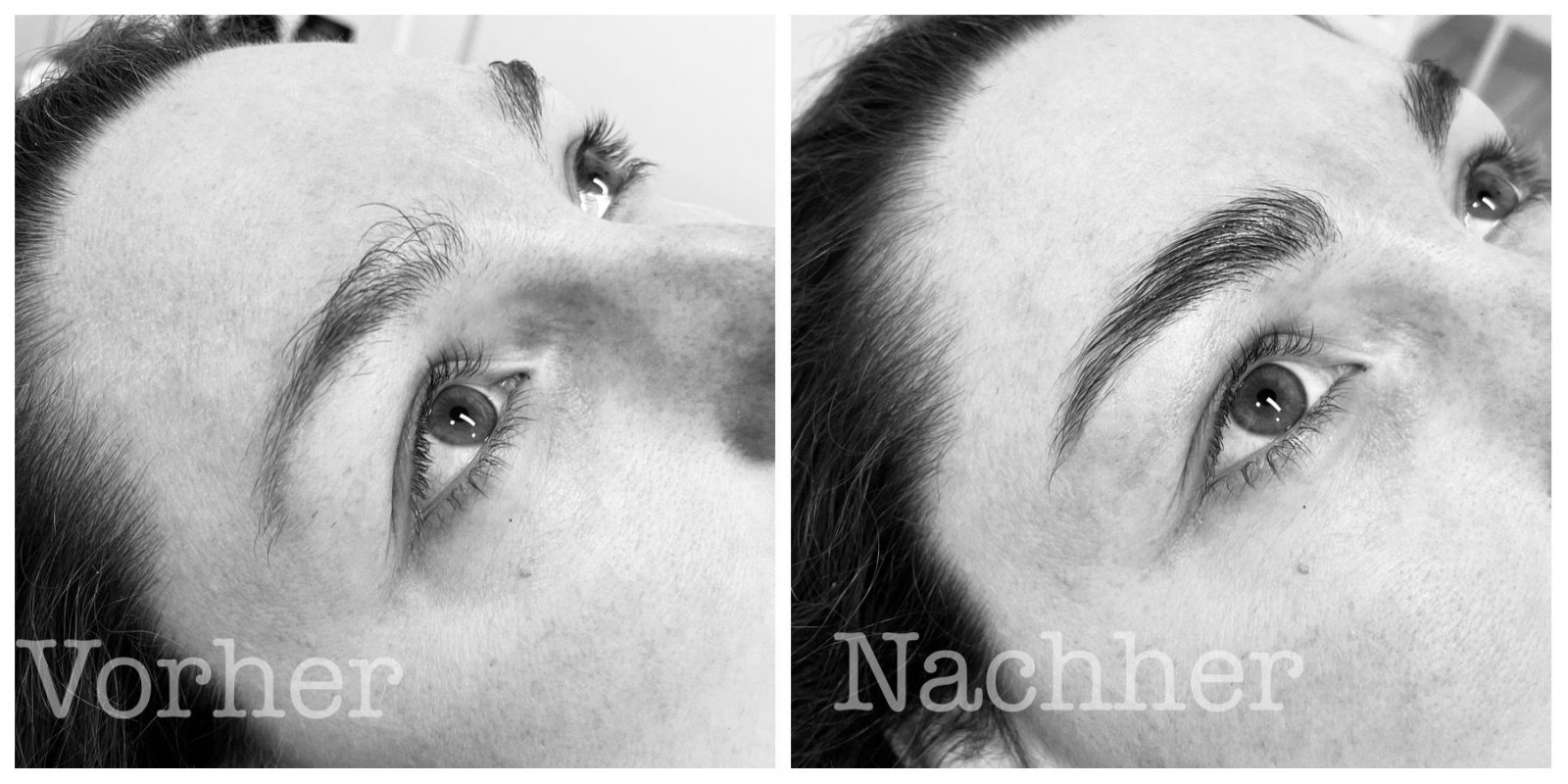 Vorher - Nachher Browlifting