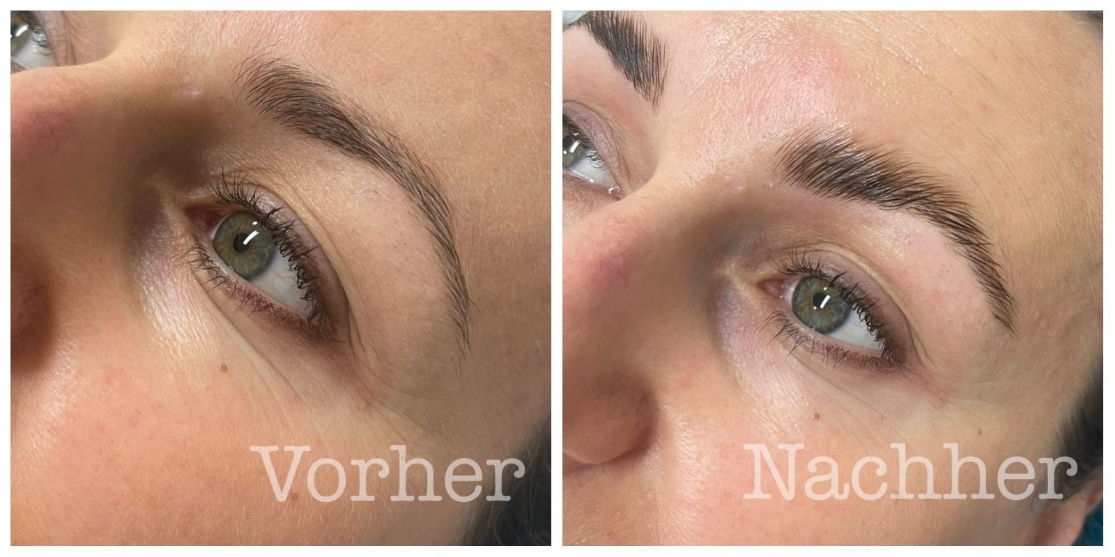 Vorher - nachher Browlifting 2