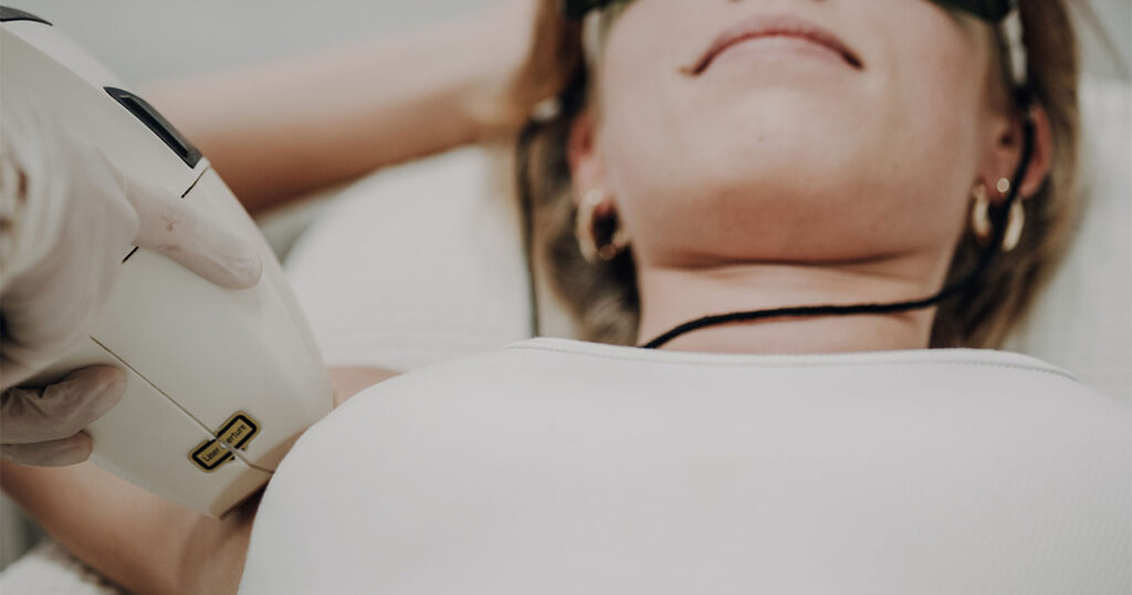 Dauerhafte Haarentfernung mit Laser